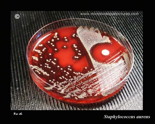s.aureus in Petri dish